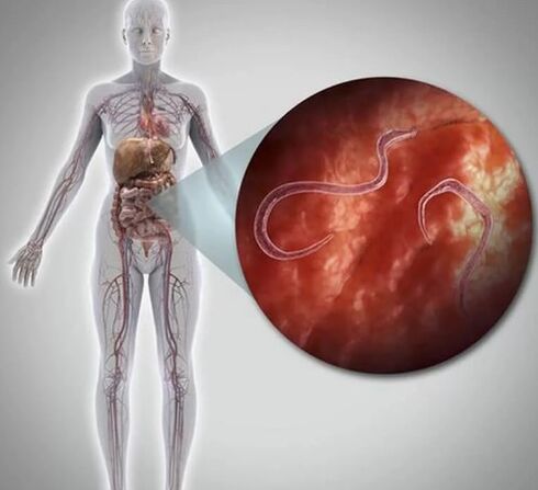 Parásitos en el cuerpo