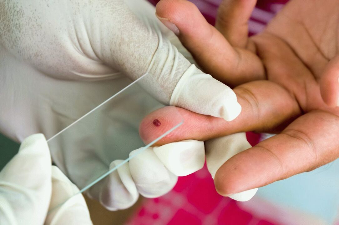 Análisis de sangre fuera del dedo