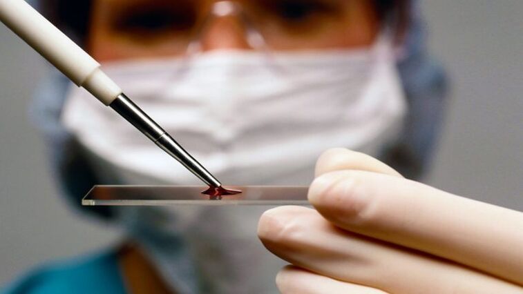 Muestra de sangre