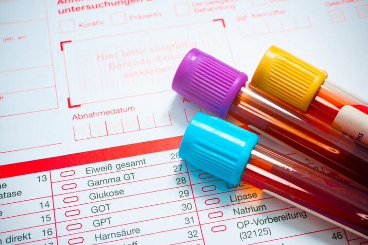 Sangre para la investigación en parásitos