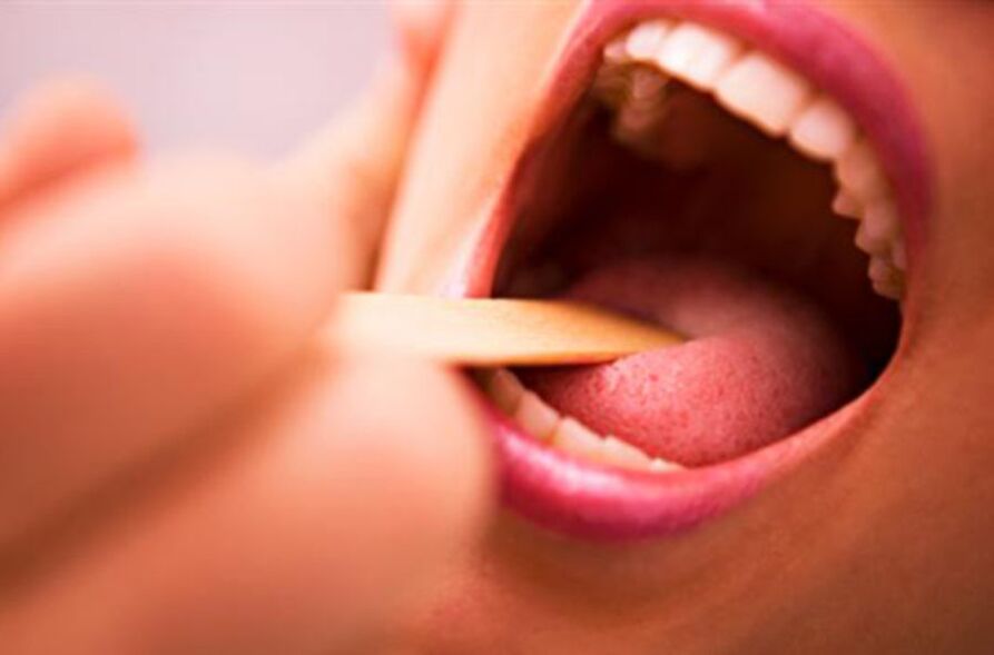 Tipos de parásitos en la boca humana.