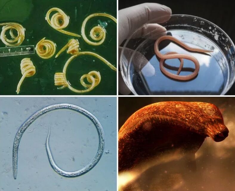 Tipos de gusanos en el cuerpo humano.